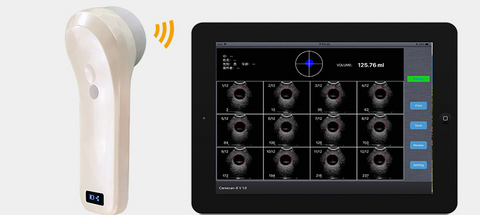 BP Sonde d'échographie  4D sans fils WiFi (iOS), urologie